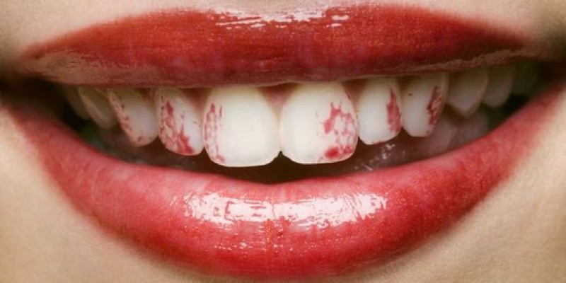 cliomakeup-errori-rossetti-liquidi-13-rossetto-sui-denti