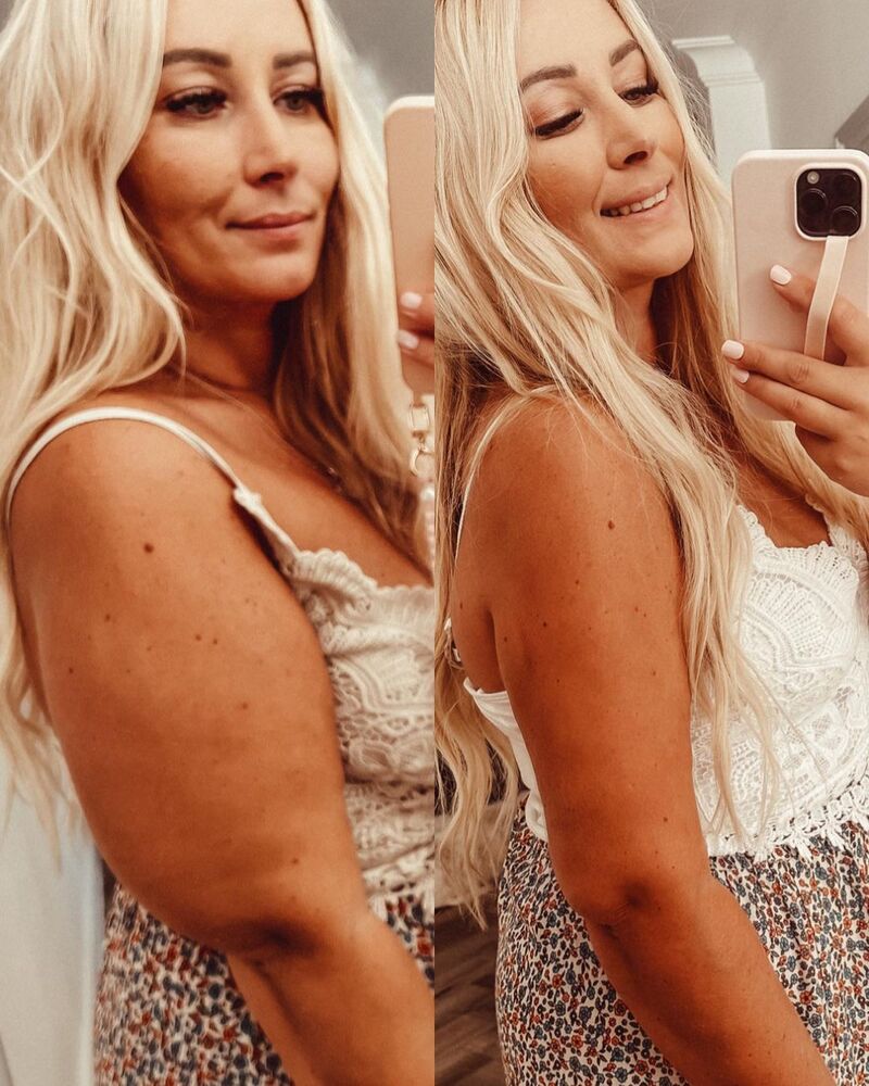 cliomakeup-lipolaser-prima-dopo
