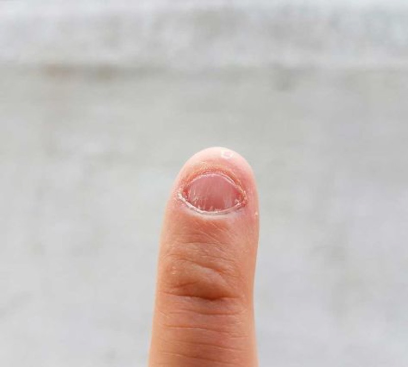 cliomakeup-cosa-c'è-sotto-le-unghie-5-mangiarle