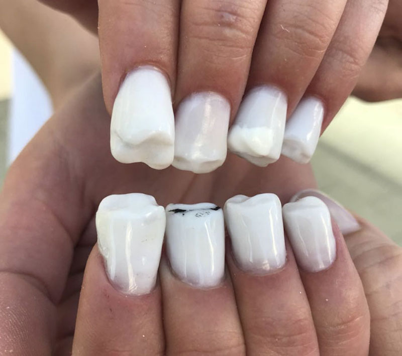 cliomakeup-manicure-brutte-5-denti