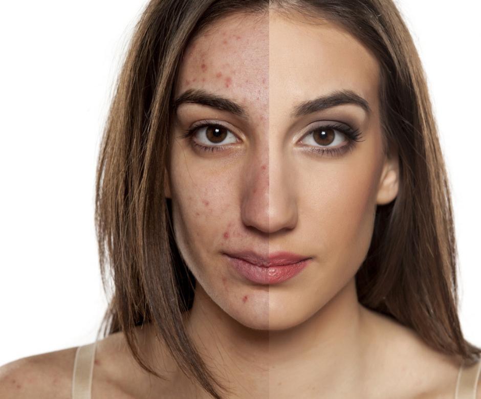 cliomakeup-peeling-viso-fai-da-te-13-bifaccia