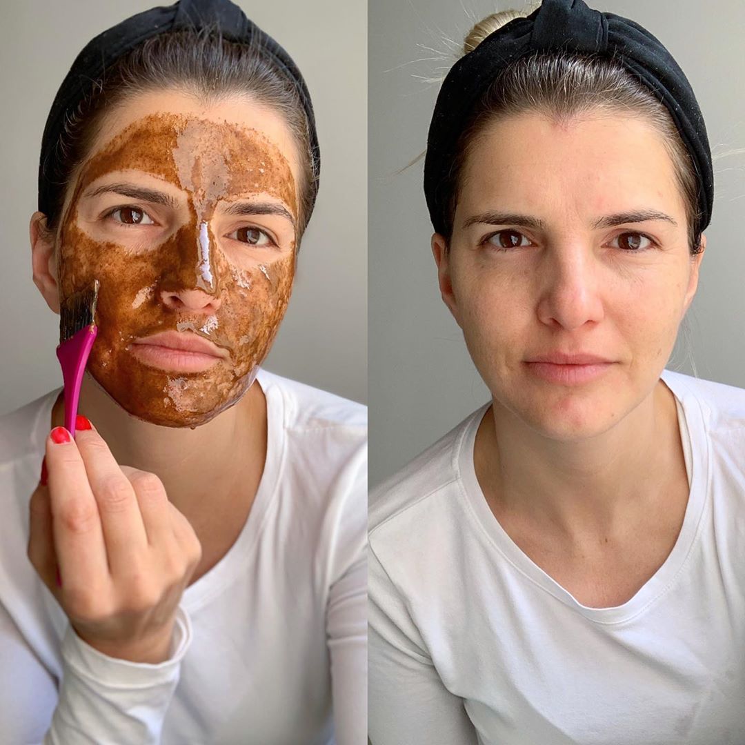 cliomakeup-peeling-viso-fai-da-te-2-prima-dopo