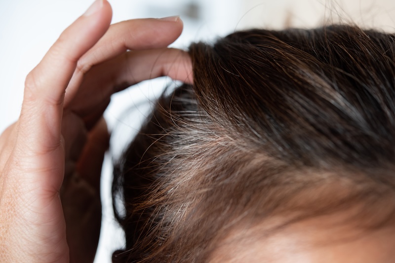 come-tornare-capelli-bianchi-ricrescita