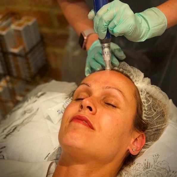 Cliomakeup-dermaroller-usi-domande-11-dermapen-viso
