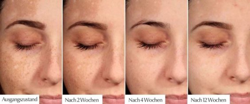 cliomakeup-creme-schiarenti-viso-11