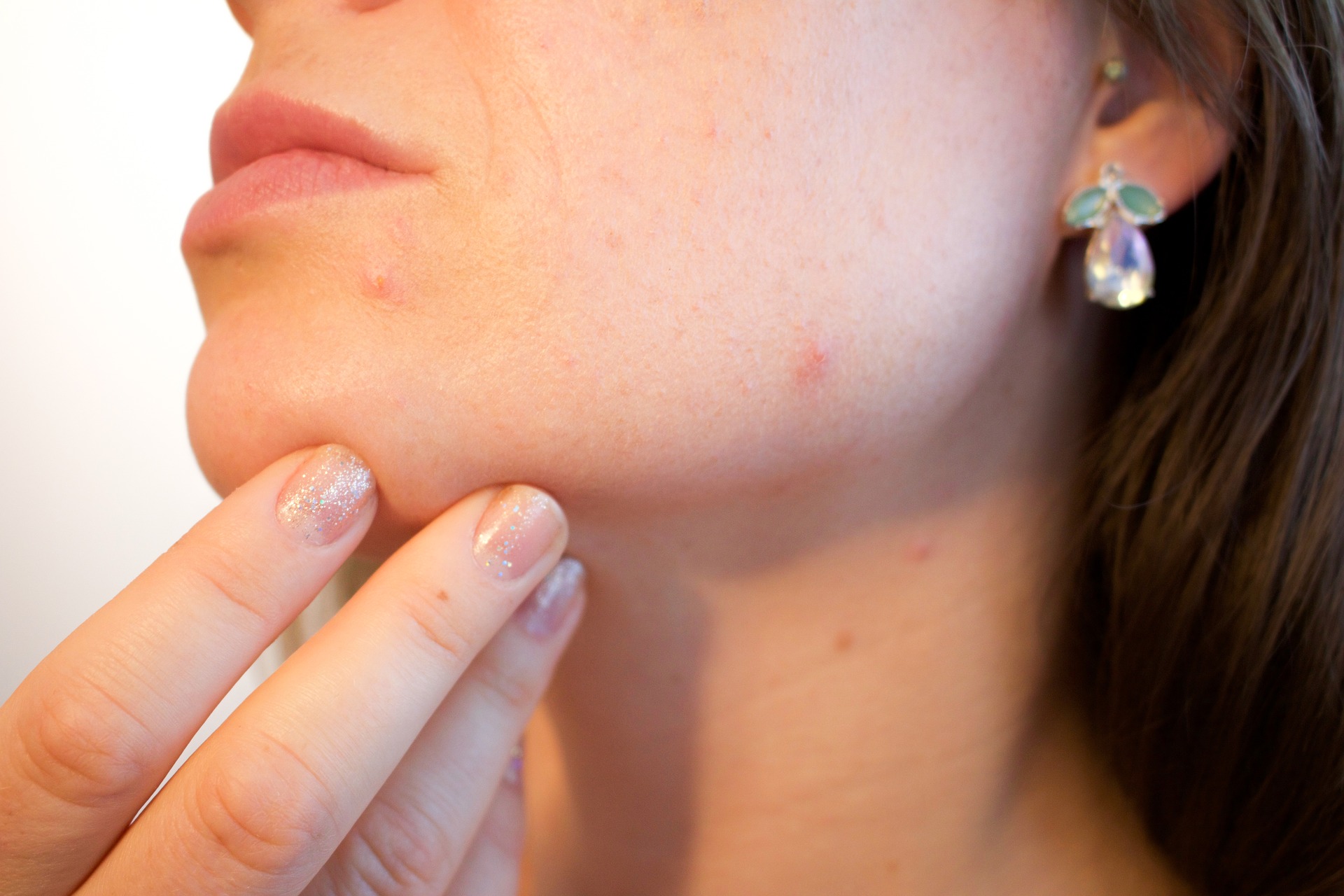 Cliomakeup-gel-mousse-pelle-viso-14-acne