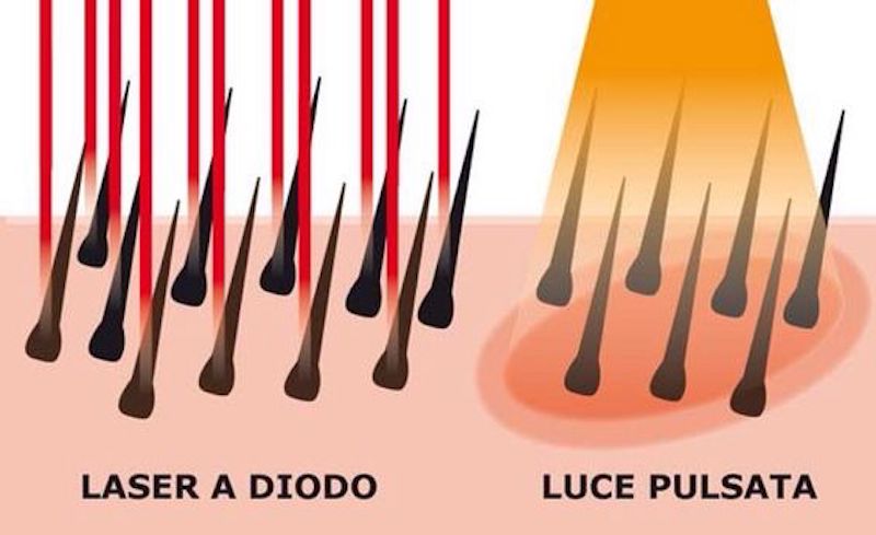 cliomakeup-epilazione-e-depilazione-15