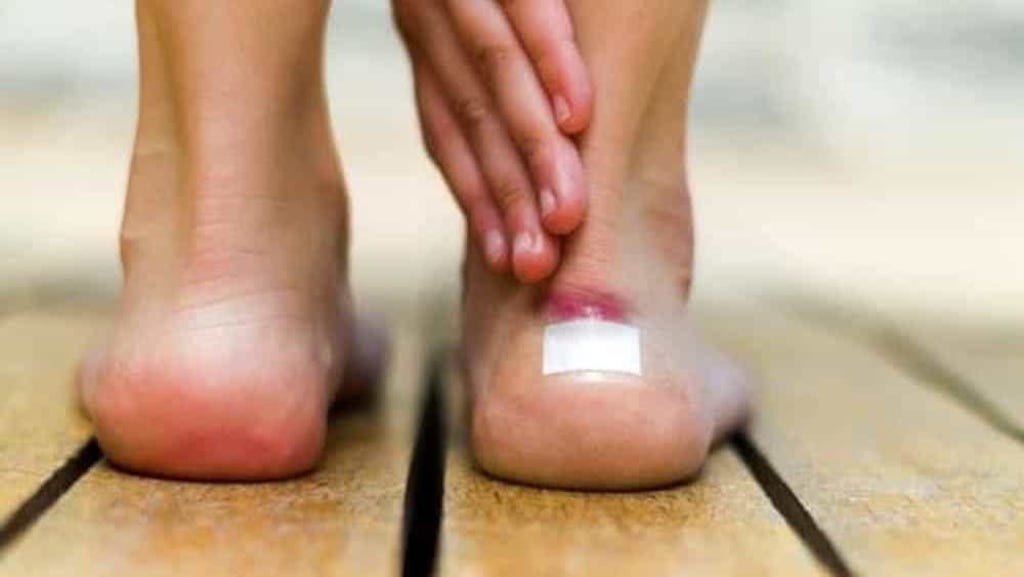 cliomakeup-come-evitare-vesciche-ai-piedi-1