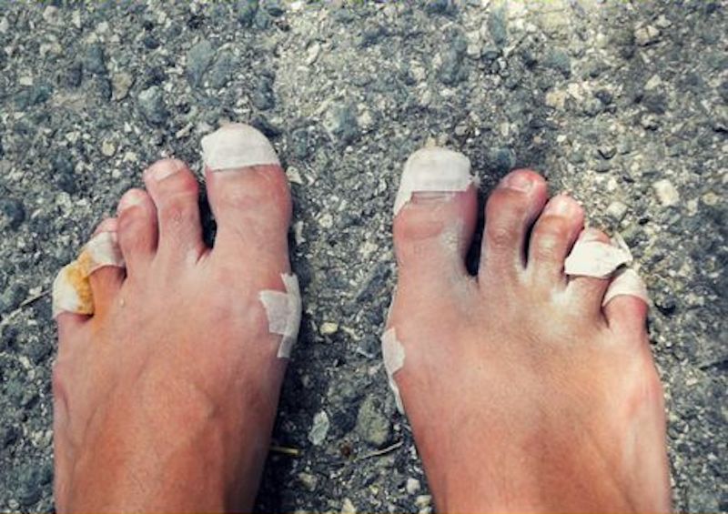 cliomakeup-come-evitare-vesciche-ai-piedi-12