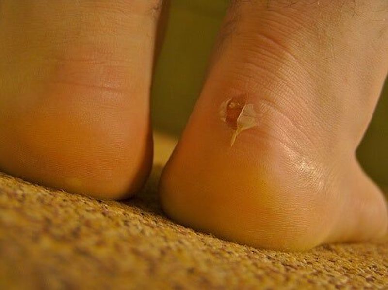 cliomakeup-come-evitare-vesciche-ai-piedi-3