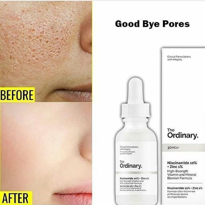 cliomakeup-niacinamide-the-ordinary-teamclio-6