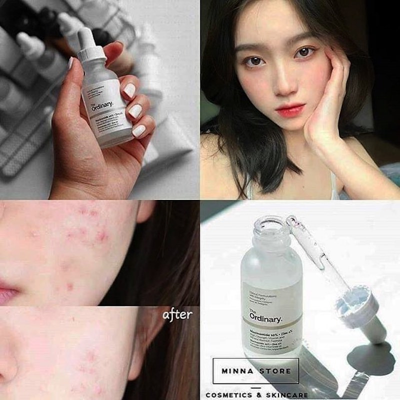 cliomakeup-niacinamide-the-ordinary-teamclio-9