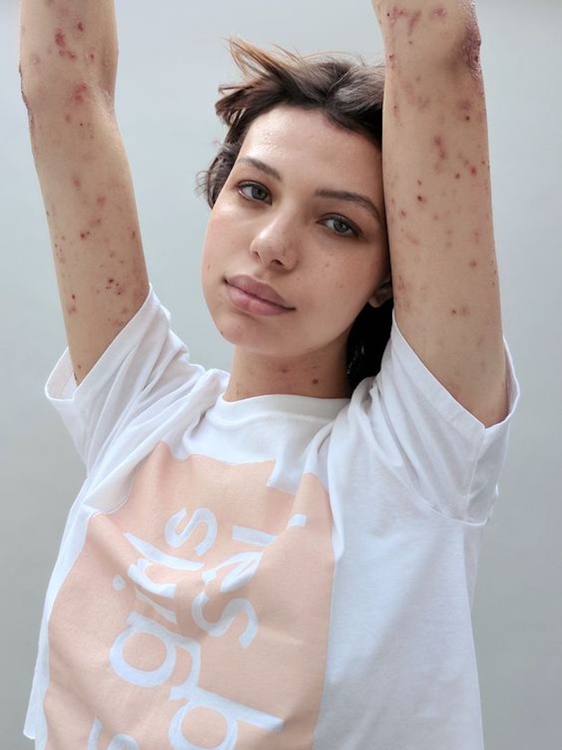 cliomakeup-effetto-rebound-acne-10