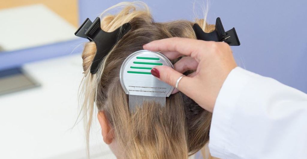 cliomakeup-pidocchi-capelli-1-Pediculosi-pidocchi