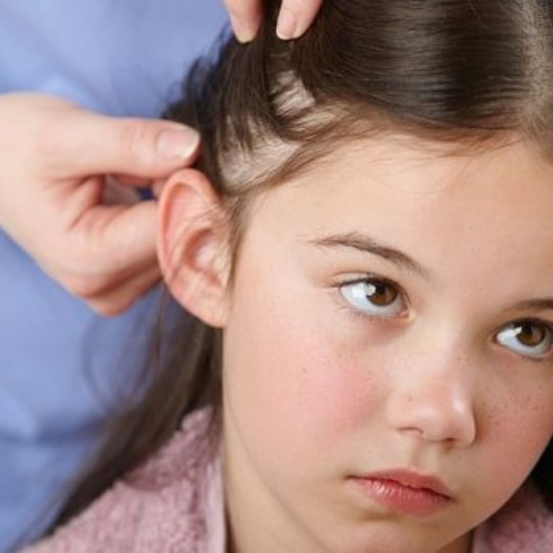 cliomakeup-pidocchi-capelli-14-Pediculosi-pidocchi