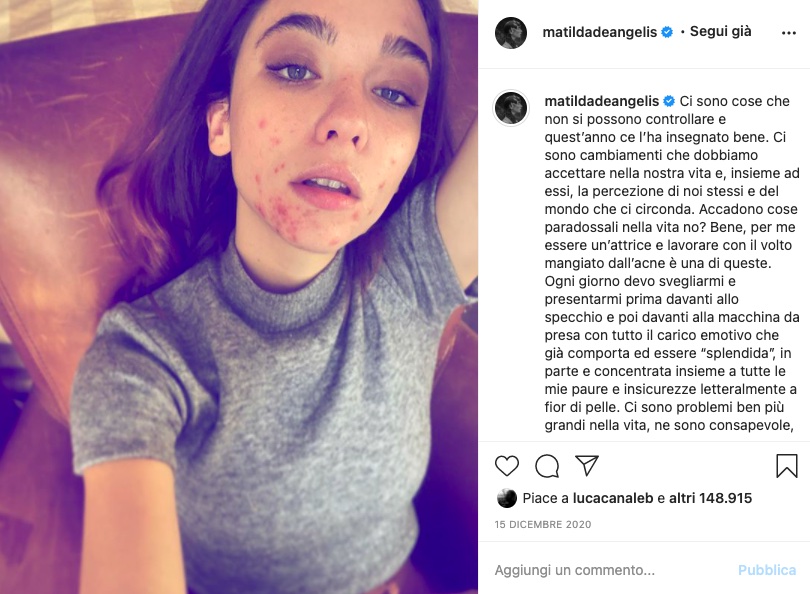 Cliomakeup-look-matilda-de-angelis-21-acne