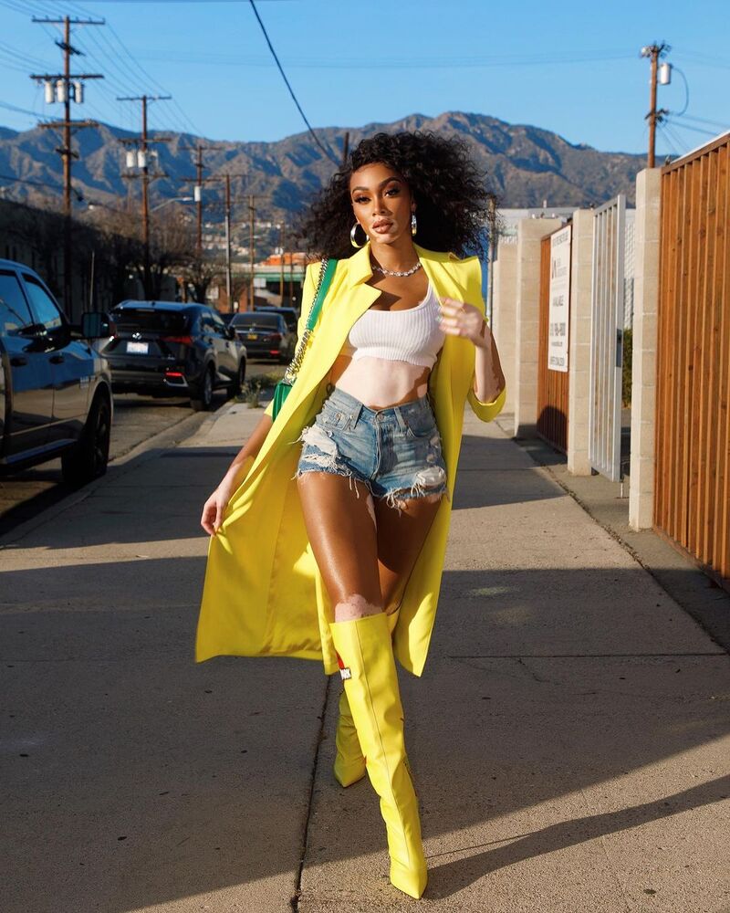 cliomakeup-star-con-vitiligine-winnie-harlow-modella