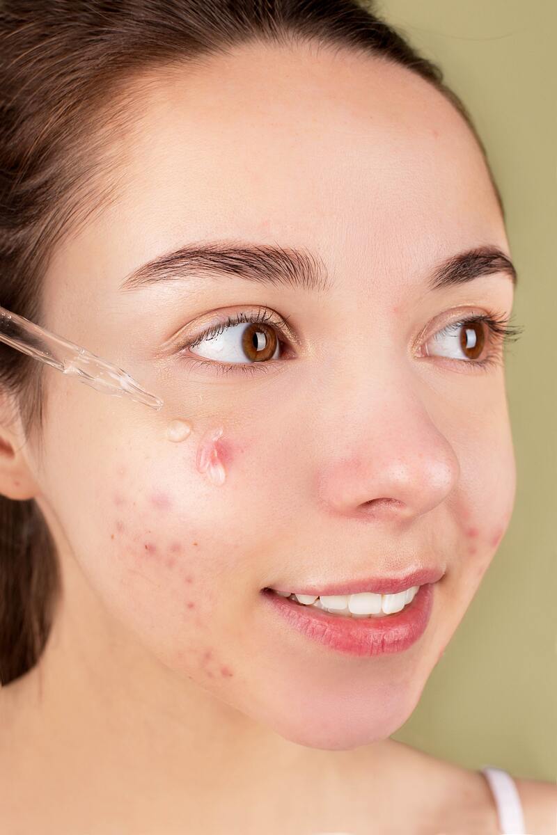 cliomakeup-olio-di-karanja-acne