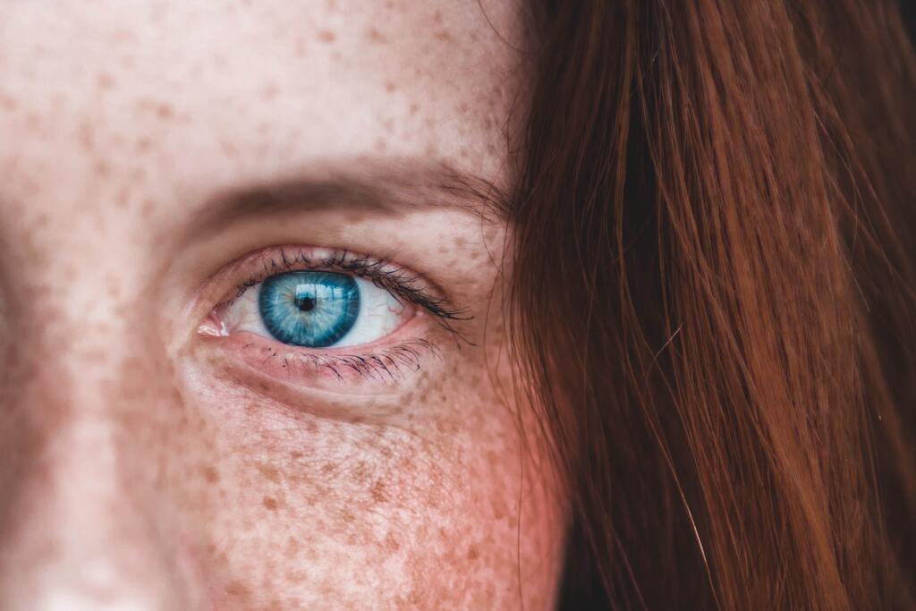 cliomakeup-melasma-cloasma