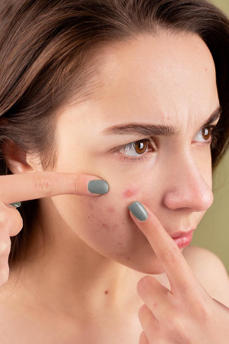 cliomakeup-come-scegliere-colore-correttore-online-acne