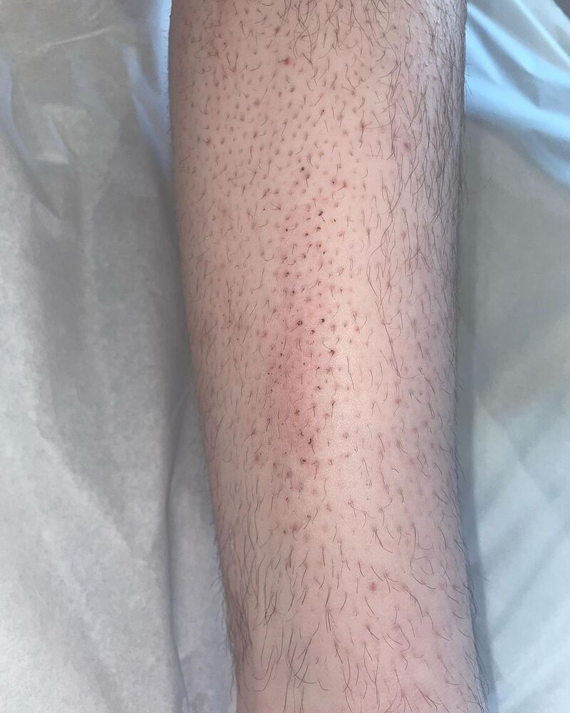 cliomakeup-pietra-depilatoria-contro