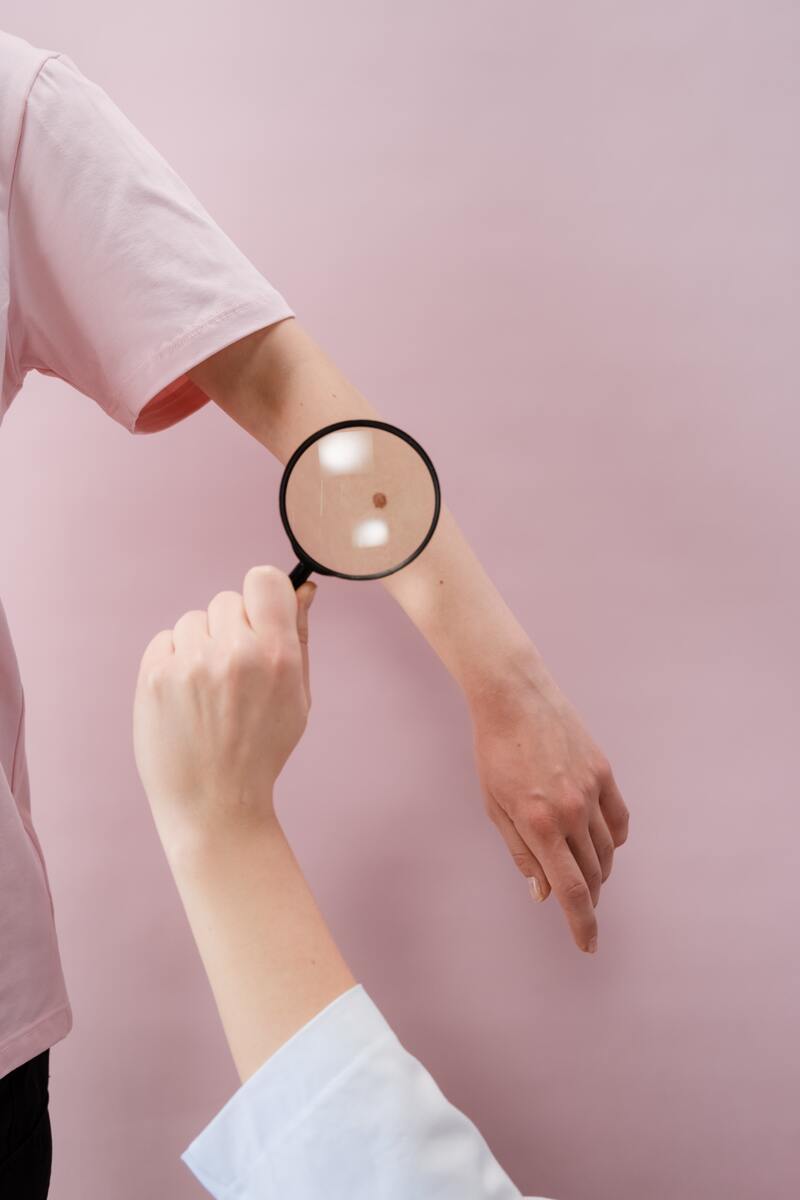 cliomakeup-melanoma-sintomi