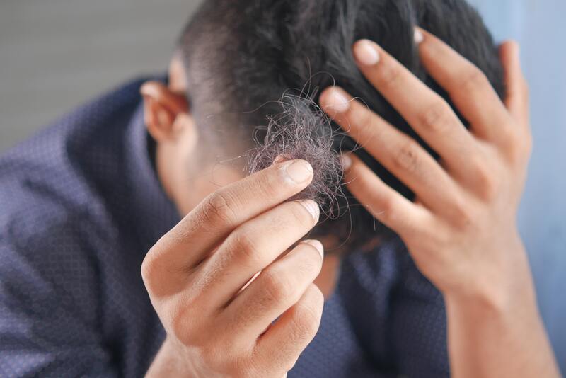 cliomakeup-alopecia-ciocche