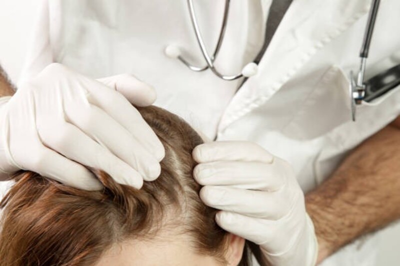 cliomakeup-alopecia-valutazione-medica