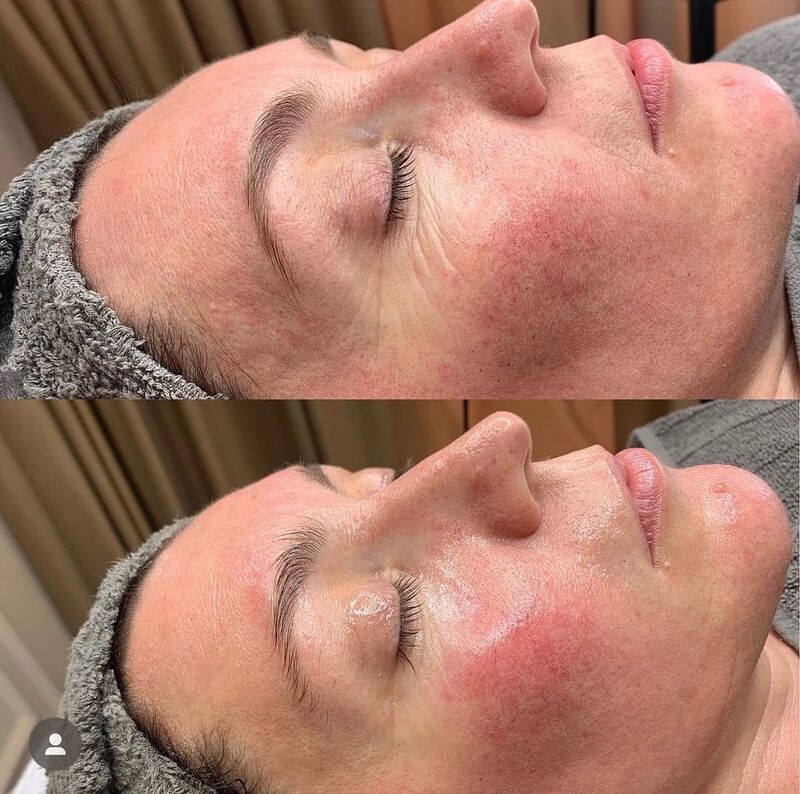 cliomakeup-trattamenti-viso-pelle-matura-dsvline