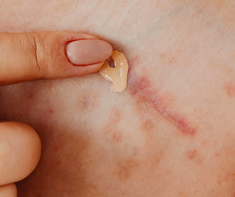 cliomakeup-errori-occhiaie-applicazione-texture-correttore-sbagliata