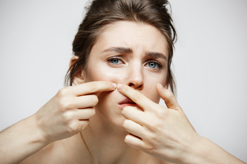 cliomakeup-skin-purging-2