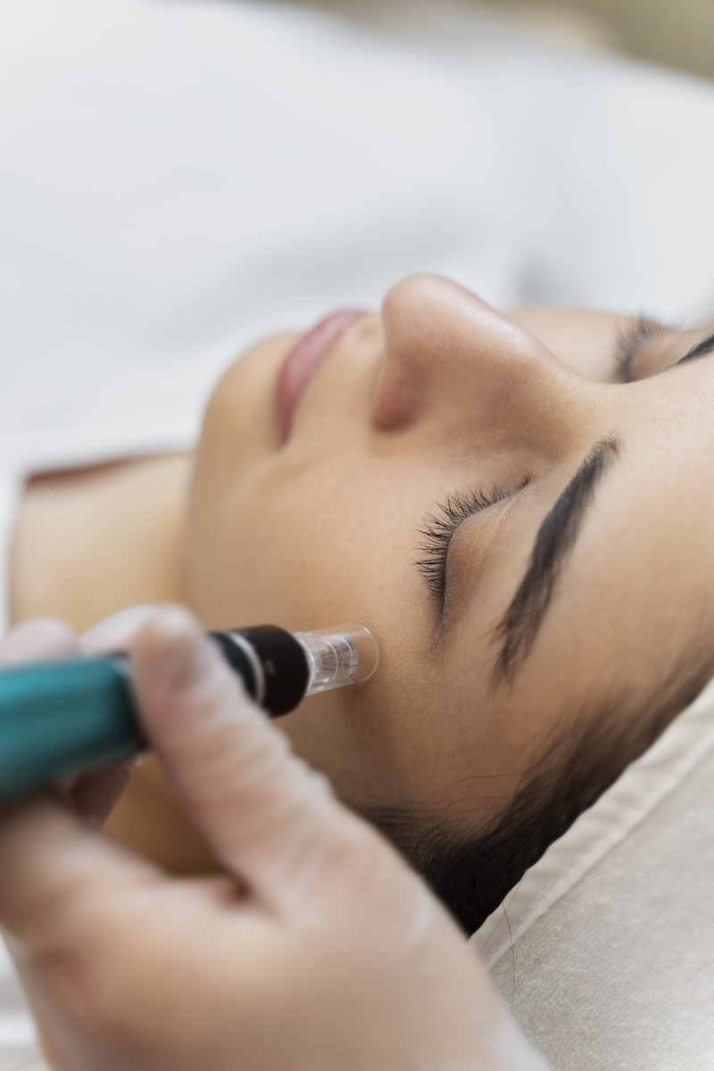 cliomakeup-skin-purging-6