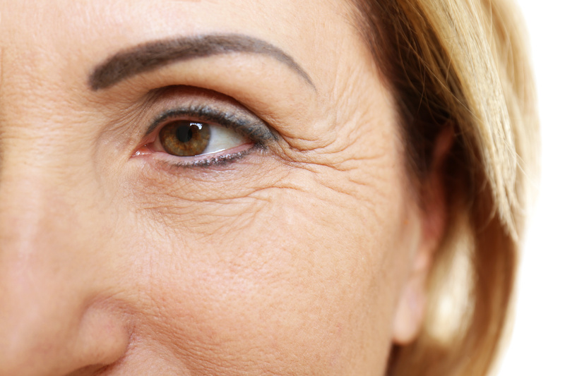  cliomakeup-rughe-profonde-superficiali-occhi