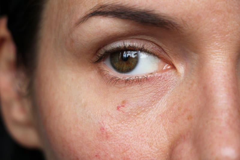 cliomakeup-pelle-matura-sottile-capillari