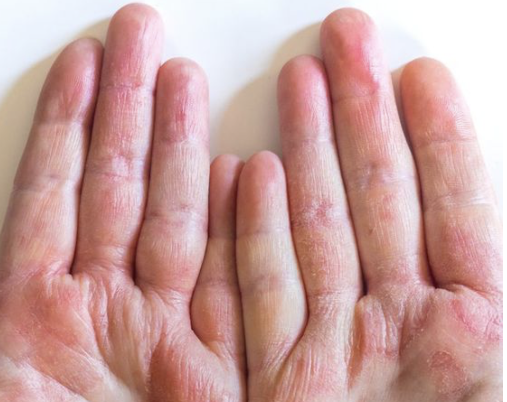 come-usare-cicaplast-la-roche-posay-modi-sfruttare-benefici-bambini-dermatite-mani