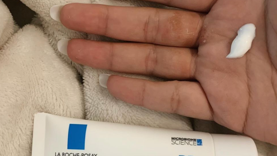 come-usare-cicaplast-la-roche-posay-modi-sfruttare-benefici-mani