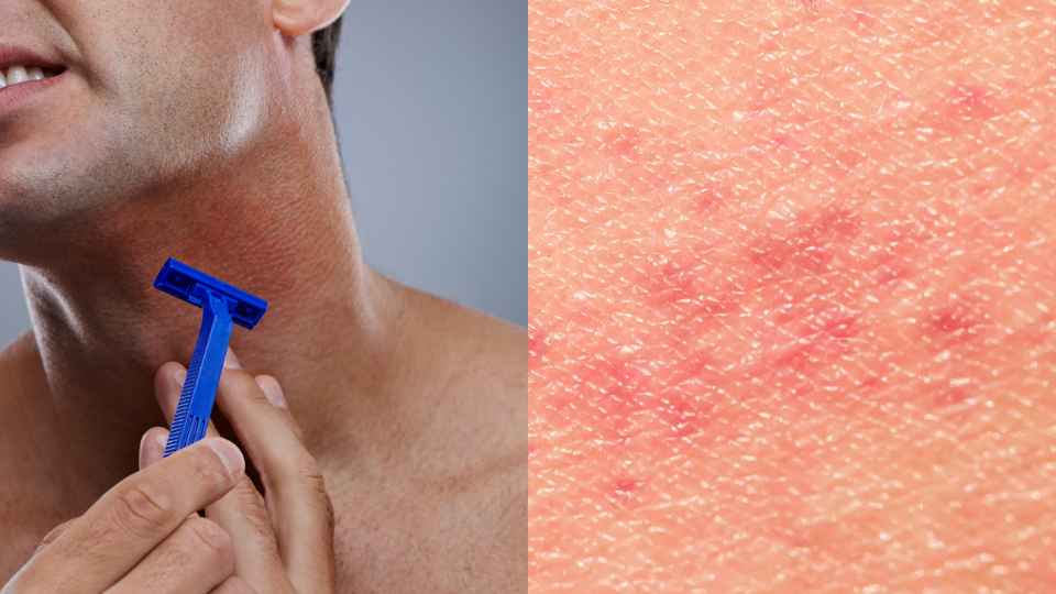 come-usare-crema-idratante-corpo-viso-rasatura-pelle-irritata